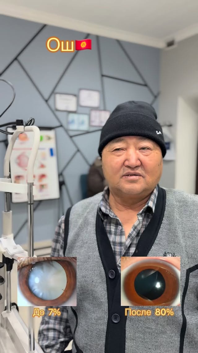 Лечение катаракты ФЭК